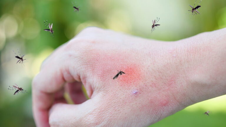 3 formas de usar essa erva para afastar mosquitos de vez 27 mosquitos 1757957109824
